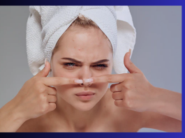 Skin Care Tips : You are also removing blackheads in this way! If yes, then understand that your skin is getting spoiled.