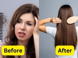 How to stop hair fall: Hair fall will stop immediately, do these 5 things from today…