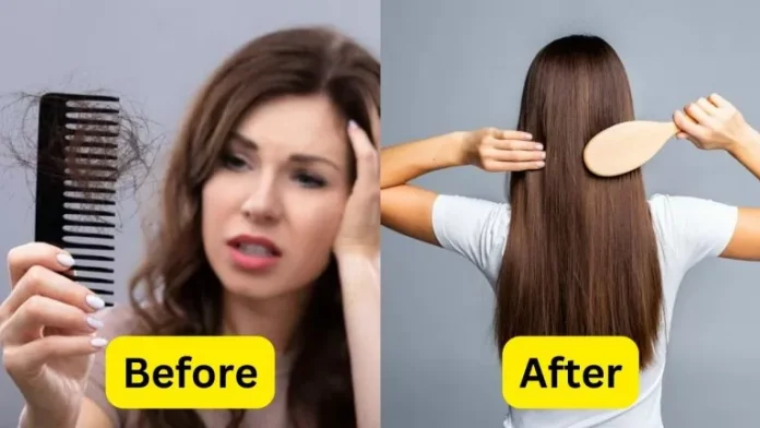 How to stop hair fall: Hair fall will stop immediately, do these 5 things from today…