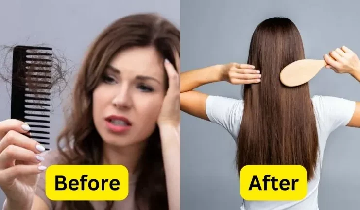 How to stop hair fall: Hair fall will stop immediately, do these 5 things from today…