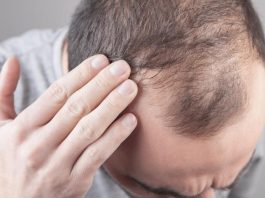 Hairfall: Why does hair fall and what is the reason for baldness, know 5 major reasons