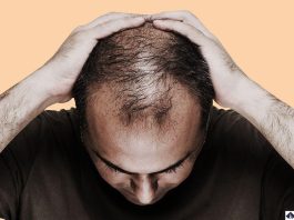 Home remedy to stop hair fall: Hair fall and baldness will not occur throughout life, start applying these home remedies from today