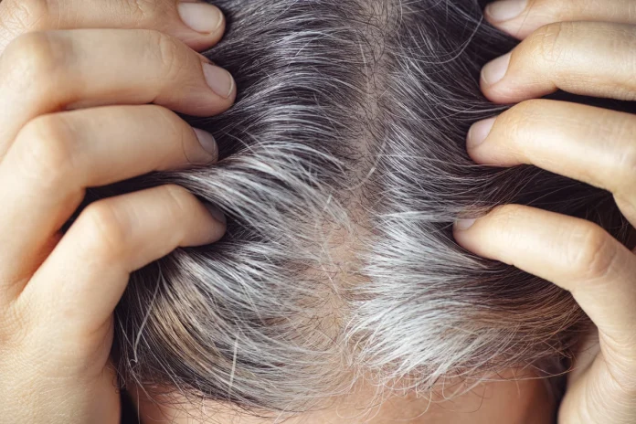 White hair : This magical oil will cure graying hair, lost youth will return from the very first use.