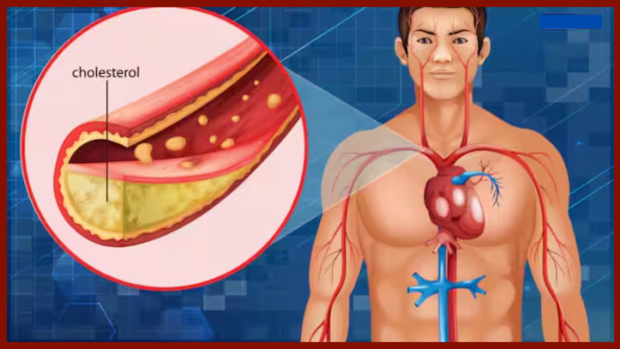 Cholesterol Control Tips! Consuming this one leaf will control cholesterol, know how to consume it