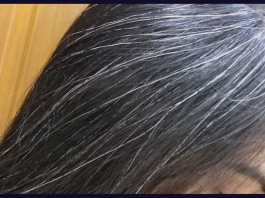 Grey Hairs Remedy: Are you troubled by grey hair? Try Baba Ramdev's 5 Ayurvedic remedies
