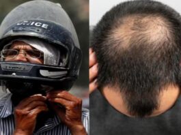 Hair Fall and Helmet: Does wearing a helmet really cause hair loss? Keep hair fall under control with these simple tips.