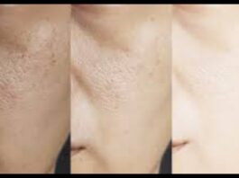 Looking to get rid of open pores and dry skin this winter? Learn these 5 great home remedies for glowing skin.